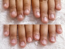 深爪矯正 爪悩み専門店 グラシナ 西宮北口店【4/3 NEW OPEN（予定）】/(深爪/長さだし/フィルイン)