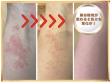 笑うヘソ歌う脳 銀座店/腸が変わると肌にも変化が