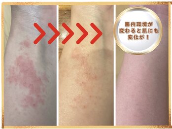 笑うヘソ歌う脳 銀座店/腸が変わると肌にも変化が