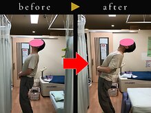 杉本接骨鍼灸院/若々しい背骨を取り戻す整体
