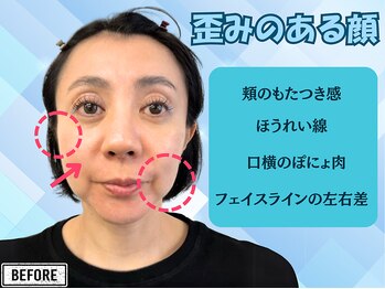 ナチュラルパーフェクトフェイス 新宿/歪みのある顔