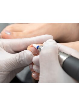 爪の悩みを解消できる（ケア含む）