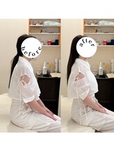 えにし整体 鍼灸整骨院/えにし式筋膜リリース整体