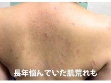 ピアンヌ(Piannu.)/