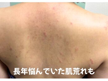 ピアンヌ(Piannu.)/