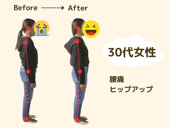 アロゼ/姿勢矯正　30代女性