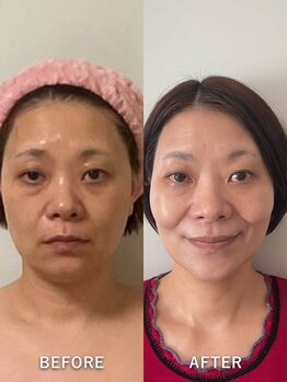 メディカルサロン レムリア/マイナス10歳若見え