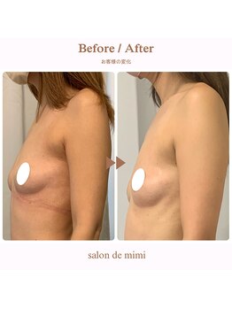 サロン ド ミミ(salon de mimi)/バストアップBeforeAfter