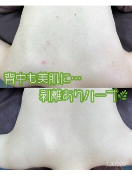 ラエッセ(LAESSE)/お体のお悩みもお任せください♪