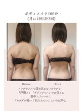 トゥインクル 麻布(twinkle)/南麻布/勝山式美容矯正/小顔矯正