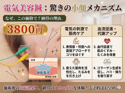 カエデ(Kaede)の写真