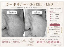 ステラ(STELLA)の雰囲気（脱毛だけで良いって思ってない？メンズも肌ケアする時代☆）