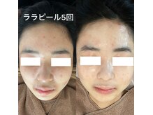 プティ 横浜店(Petit)/ララピール