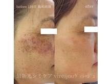 プライベートアイラッシュサロン ヴィレージュ 稲毛店(Vireijou)