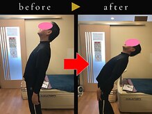 杉本接骨鍼灸院/若々しい背骨を取り戻す整体