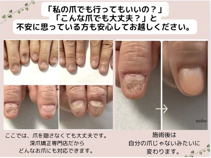 ネイルズシアムの写真