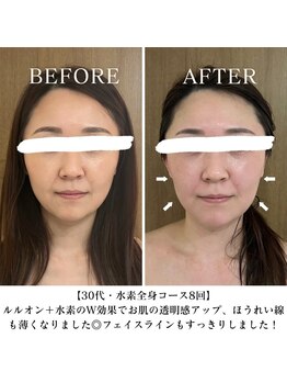 ヨサパーク リバティ 池袋東口店(YOSA PARK Liberty)/Before&after