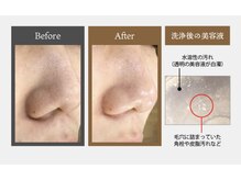 エミタス整骨院の雰囲気(大人気毛穴洗浄!黒ずみ・ニキビ・くすみにお悩みの方におすすめ)