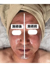 チュベルフェ(tu belle fe)/ギノーVAR