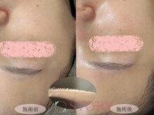 ストーリー(STORY)/眉毛と艶肌ワックス専門店