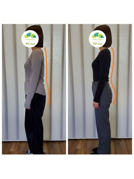 ポーノ(po-no)/美姿勢before→after