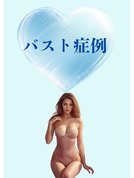 プレジール/バストケア卒業されたお客様