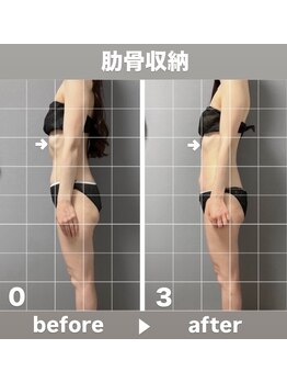 メゾン ド クロエ(Maison de Chloe)の写真/【ブライダル痩身】直前でも整う*骨格から仕立てる、ドレス映えボディ