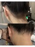 【人気部位】うなじ脱毛 2,200円