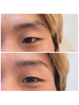 イードット(E.)/垢抜け♪流行りの顔に♪