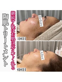 マリアム(mariam)/ハーブの力で細胞が生まれ変わる