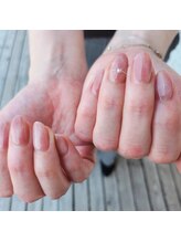 プロケア リッシュ(Procare Riche)/