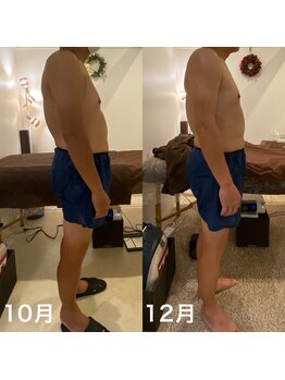 アムズ(Am’s)/【ENG】反り腰の姿勢よる疲れ