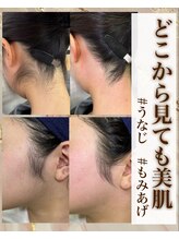 ギューテ(Gute)/うなじ脱毛