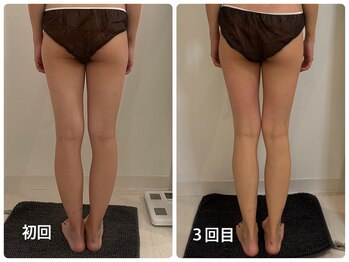 ナビ(NABI)/筋膜リリース