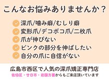 ネイルサロン プロムナード(nailsalon promnade)/広島市西区で人気の深爪矯正