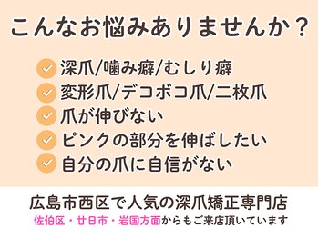 ネイルサロン プロムナード(nailsalon promnade)/広島市西区で人気の深爪矯正
