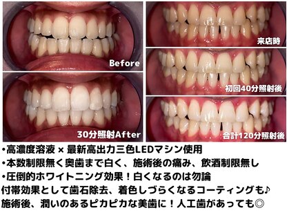 ライトビューティー 関内店(LIGHT BEAUTY)の写真