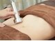 カロンボーテ メディスリム(calonbeaute Medi Slim)の写真/二重あご/頬肉/膝上/内ももなどいらない脂肪を徹底燃焼！寝ている間にスッキリとしたフェイスラインに♪