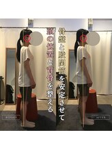 岡山整体 リソル(Resol)/姿勢改善ビフォーアフター