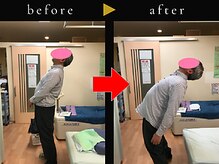 杉本接骨鍼灸院/若々しい背骨を取り戻す整体