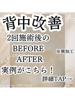 ケア ラウンジ ザ ファースト(THE F1RST)/背中改善＊