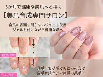 ルシェルアイ