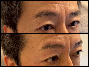 スリーピース(3Peace)/ストレートアーチ眉Before/After