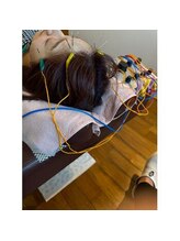 爽健美/電気を流す美容鍼