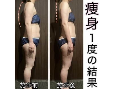 ビューティサロンツリー(TREE)の写真