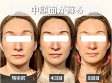 フレキシボディ(FlexiBody)の雰囲気（小顔矯正の回数を重ねる事で、リバウンドしない小顔へ導きます！）