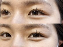 チッパー(CHIPPEr)/ラッシュリフト