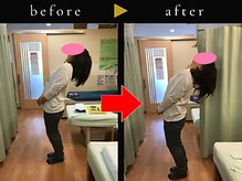 杉本接骨鍼灸院/若々しい背骨を取り戻す整体