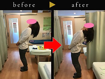 杉本接骨鍼灸院/若々しい背骨を取り戻す整体