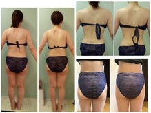 肩甲骨がすっきりしました♪美尻ゲットや、くびれもくっきり◎